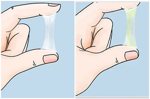 Triệu chứng bệnh lậu ở nữ giới Triệu chứng của bệnh lậu ở nữ giới